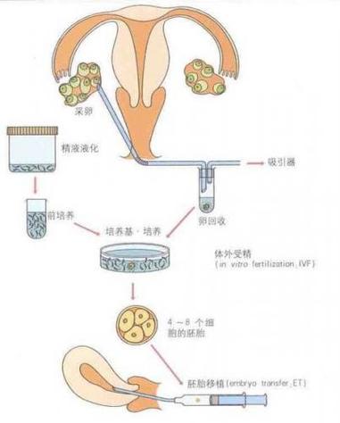 借卵试管代怀是什么-借卵试管代怀:解析背后的医学与伦理意义